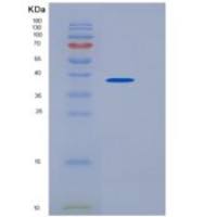 小鼠IL1R1 / CD121a重组蛋白His tag