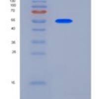 人DLL4 / Delta4重组蛋白His tag