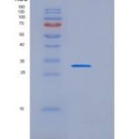 小鼠CD209B / DC-SIGNR1重组蛋白His tag