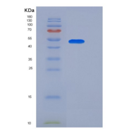 人B7-H3 / CD276重组蛋白His tag