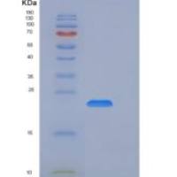 大鼠LCN2 / NGAL重组蛋白His tag