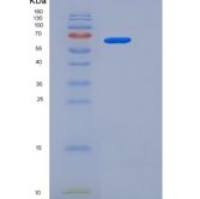 人USH1C / Harmonin重组蛋白His tag