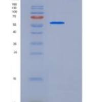 人Cochlin / COCH重组蛋白short isoform, His tag