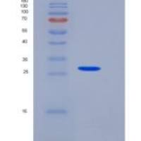 人激肽释放酶11(KLK11)重组蛋白His Tag