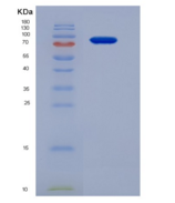 人补体成分2(C2)重组蛋白His tag