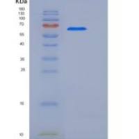 人IL1R1 / CD121a重组蛋白Fc tag