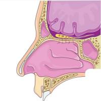 变应性鼻炎小鼠模型