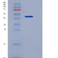 人RTN4 / NOGO-A重组蛋白GST tag