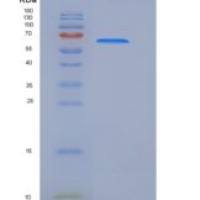 人HNMT /组胺N-甲基转移酶重组蛋白GST tag