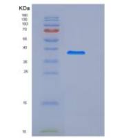 人Lumican / LUM重组蛋白His tag