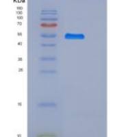 人B7-H4 / B7S1 / B7x重组蛋白Fc tag