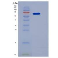 人肝配蛋白A受体3(EPHA3)重组蛋白His tag