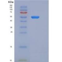人肝配蛋白A受体2(EPHA2)重组蛋白His Tag