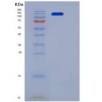 人c-MET / HGFR重组蛋白His & Fc tag