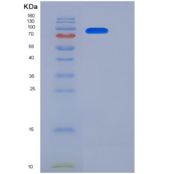 小鼠HER2 / ErbB2重组蛋白Fc tag