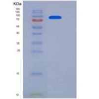 小鼠HER2 / ErbB2重组蛋白Fc tag