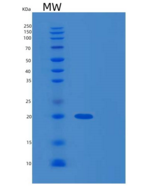 人Cystatin D重组蛋白His Tag