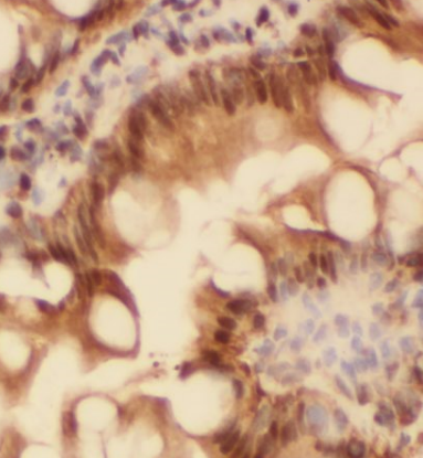 BLOC1S1-Specific antibody|BLOC