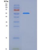人CHST15 / GALNAC4S-6ST / BRAG重组蛋白His tag
