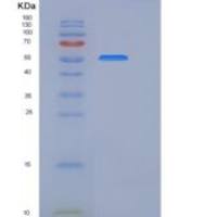 人CHST15 / GALNAC4S-6ST / BRAG重组蛋白His tag