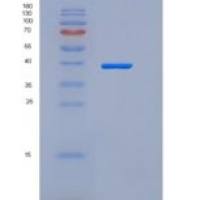 人TrkA / NTRK1重组蛋白His tag