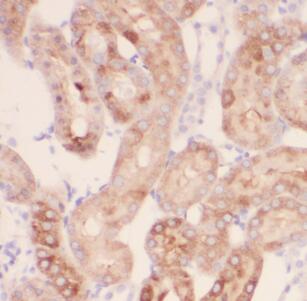 MAS1 antibody|MAS1抗体