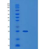 人Cystatin D重组蛋白His Tag