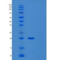 人Cystatin D重组蛋白His Tag