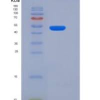 人Cathepsin C / CTSC / DPPI重组蛋白His tag