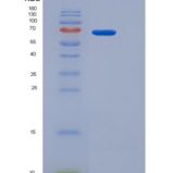 人CD97分子(CD97)重组蛋白Fc tag