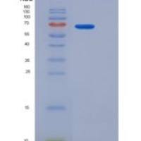 人CD97分子(CD97)重组蛋白Fc tag