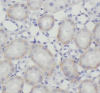 CTSC antibody|CTSC抗体