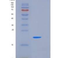 小鼠CLEC3B / Tetranectin重组蛋白His tag
