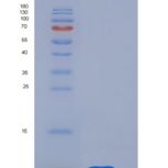 人CD9 / Tspan-29重组蛋白His tag