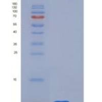 人CD9 / Tspan-29重组蛋白His tag