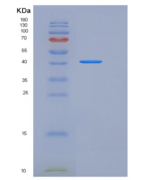 小鼠ACVR2A / ActrIIa重组蛋白His & Fc