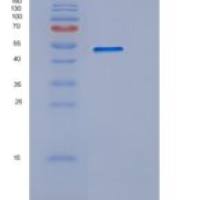 小鼠CD39 / ENTPD1重组蛋白His tag