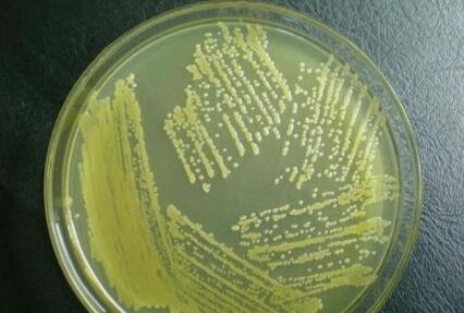 培养基倾注温度相关阐述