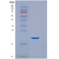 人CD7分子(CD7)重组蛋白His tag