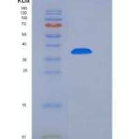 人甘油醛-3-磷酸脱氢酶(GAPDH)重组蛋白His tag