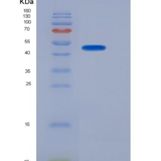 人SerpinA6 / CBG 重组蛋白His tag