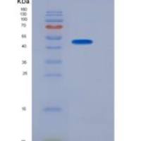 人SerpinA6 / CBG 重组蛋白His tag