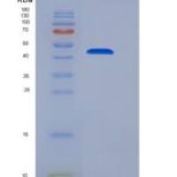 人羧肽酶M(CPM)重组蛋白His tag
