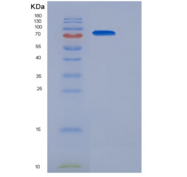 小鼠LIFR / CD118重组蛋白His tag