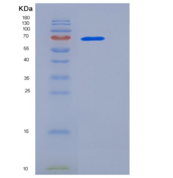 人HSPA8 / HSC70重组蛋白His tag