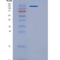 人NFASC / Neurofascin重组蛋白Fc Tag