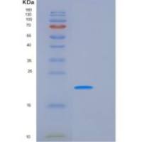 人CLEC3B / Tetranectin重组蛋白His tag