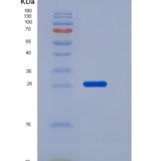 小鼠Coagulation Factor III / Tissue Factor / CD142重组蛋白His tag