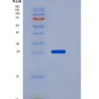 小鼠Coagulation Factor III / Tissue Factor / CD142重组蛋白His tag