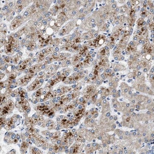 PXMP2 antibody|PXMP2抗体